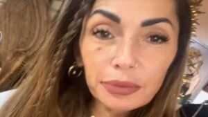 Ida Platano con un occhio nero: l’ex dama di UeD svela cosa è successo