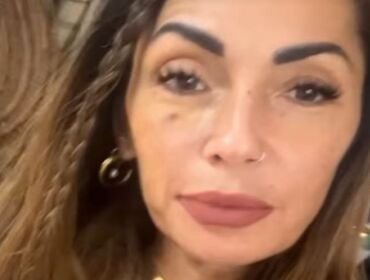 Ida Platano con un occhio nero: l'ex dama di UeD svela cosa è successo